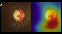 modern cikkek az oftalmológiáról